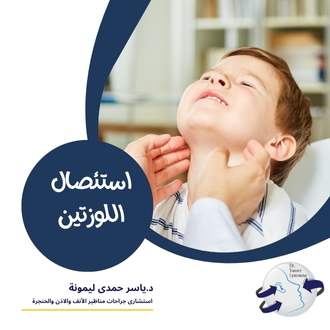 استئصال اللوزتين