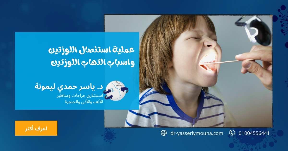 عملية استئصال اللوزتين واسباب التهاب اللوزتين