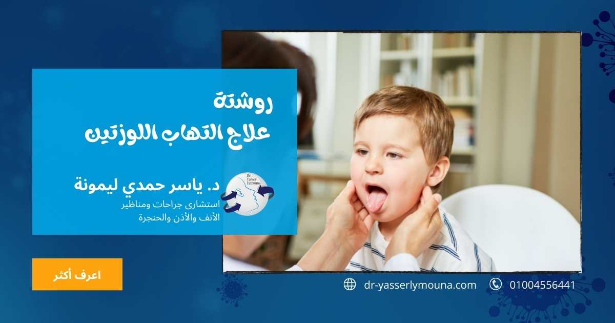 التهاب اللوزتين